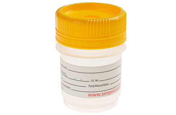 SpecTainer I スクリューキャップコンテナー タンパーエビデント 60ml 未滅菌